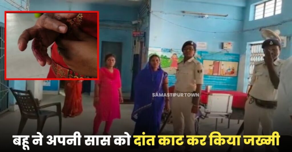 समस्तीपुर: परिवार कोर्ट में बहू ने सास को दांत काटकर किया जख्मी, नगर पुलिस ने दोनों को हिरासत में लिया 1 IMG 20221020 WA0100
