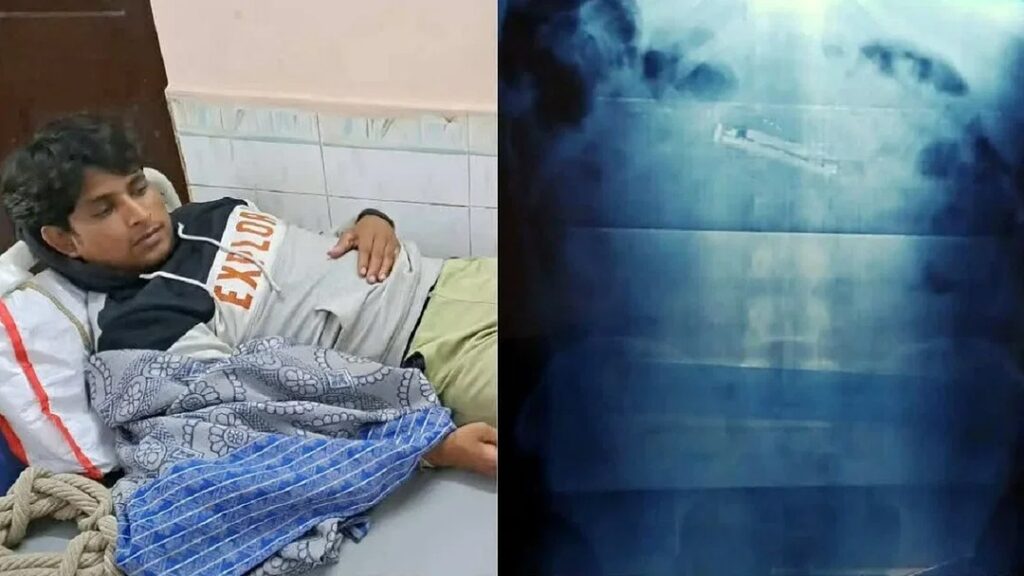 OMG! बिहार में जेल चेकिंग के दौरान मोबाइल निगल गया कैदी, भयंकर दर्द हुआ तो पहुंचा अस्पताल, जानें पूरा मामला 1 Prabhatkhabar2023 021b935e2d 0bae 47c0 9b3c fcb83ceca15bjail 01
