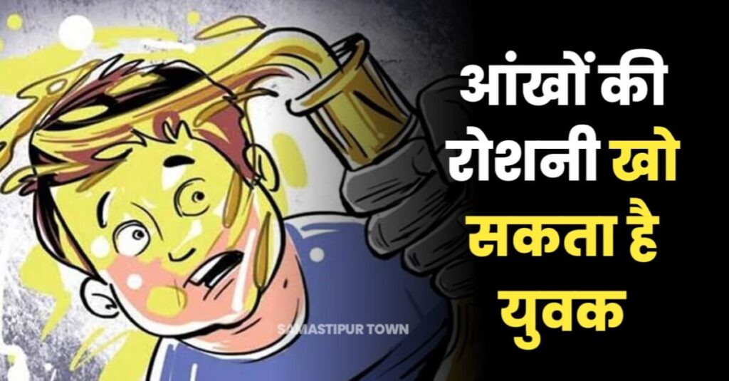 रोसड़ा में रामनवमी मेला देखने गए युवक को बेरहमी से पीटने के बाद चेहरे पर एसिड डाला, जिंदगी और मौत से लड़ रहा संजीत 1 IMG 20230331 WA0147
