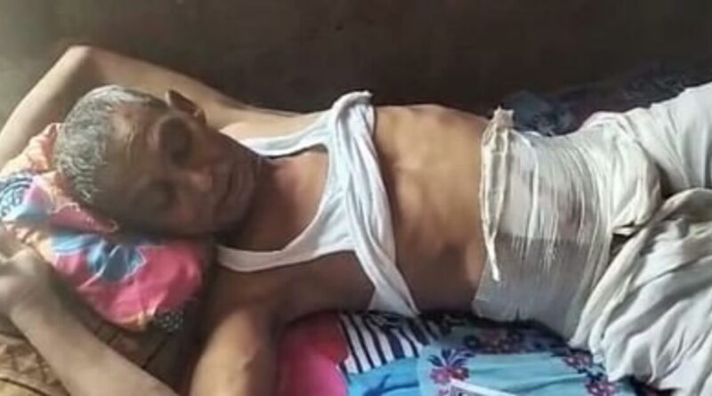 करना था हर्निया ऑपरेशन; मगर निकाल ली हाइड्रोसील, बिहार में झोला छाप डॉक्टर का नया कारनामा 1 20230513 184752