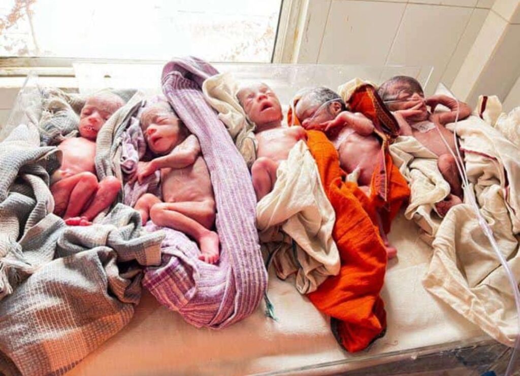 कुदरत का करिश्मा देखिये.. महिला ने एक साथ 5 बच्चों को दिया जन्म, डॉक्टर बोले- जच्चा और बच्चा स्वस्थ 1 20230523 070618