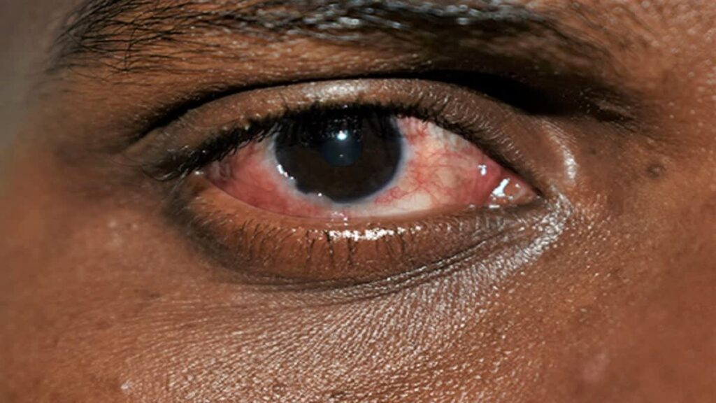 1200 675 19096210 thumbnail 16x9 eye 01