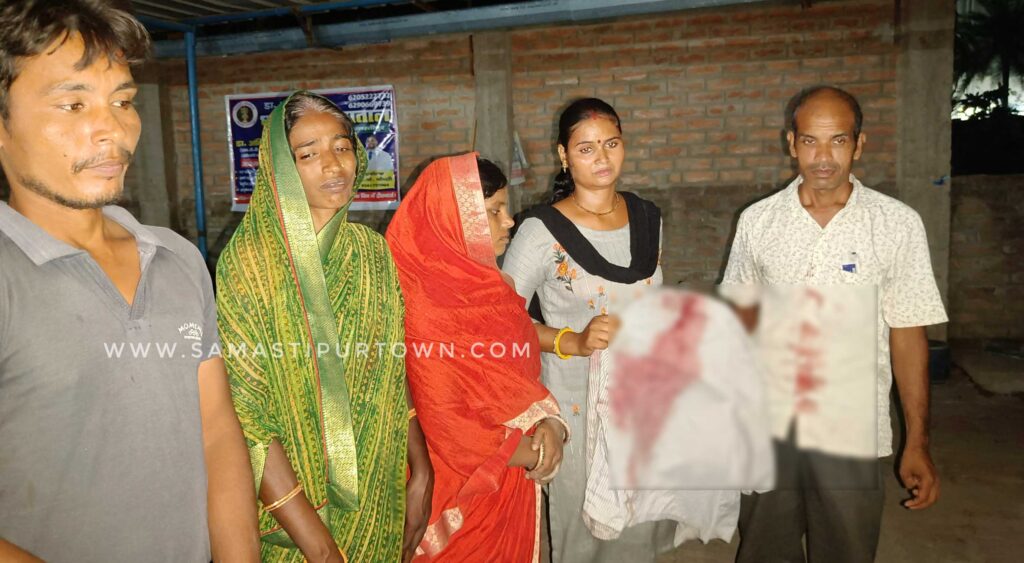समस्तीपुर में पूर्व वार्ड सदस्य को गोली मार जख्मी करने के मामले में दो नामजद और एक अज्ञात पर FIR दर्ज 1 Picsart 23 08 19 21 26 43 474