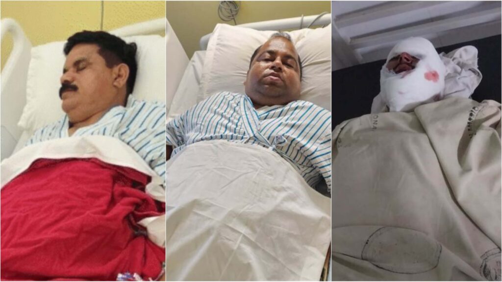 गांधी सेतु पर भाजपा सांसद सतीश दुबे की गाड़ी दुर्घटनाग्रस्त, MP समेत पांच घायल, बॉडीगार्ड और चालक की हालत गंभीर 1 Picsart 23 09 18 10 02 28 267