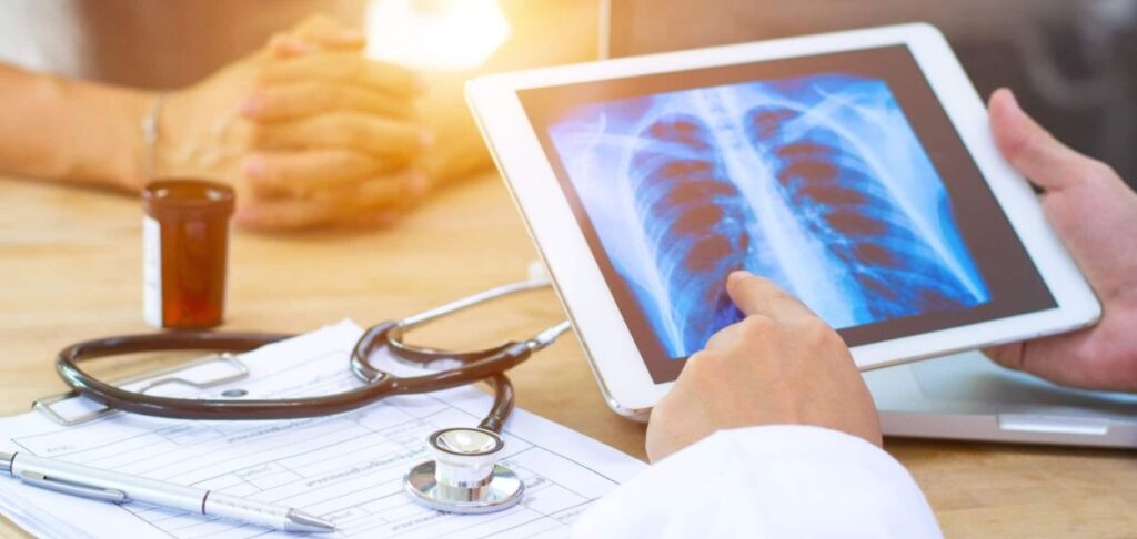 समस्तीपुर जिले भर में स्क्रीनिंग के दौरान सालभर में मिले 39 कैंसर के मरीज 1 Chest Lung Xray Doc and Patient 1180x560 1 01