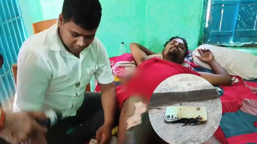 बिहार: मोबाइल पर कॉल आते ही पॉकेट में ब्लास्ट, अगर कान के पास होता तो...; जानिये कौनसी कंपनी का था फोन 1 110944532