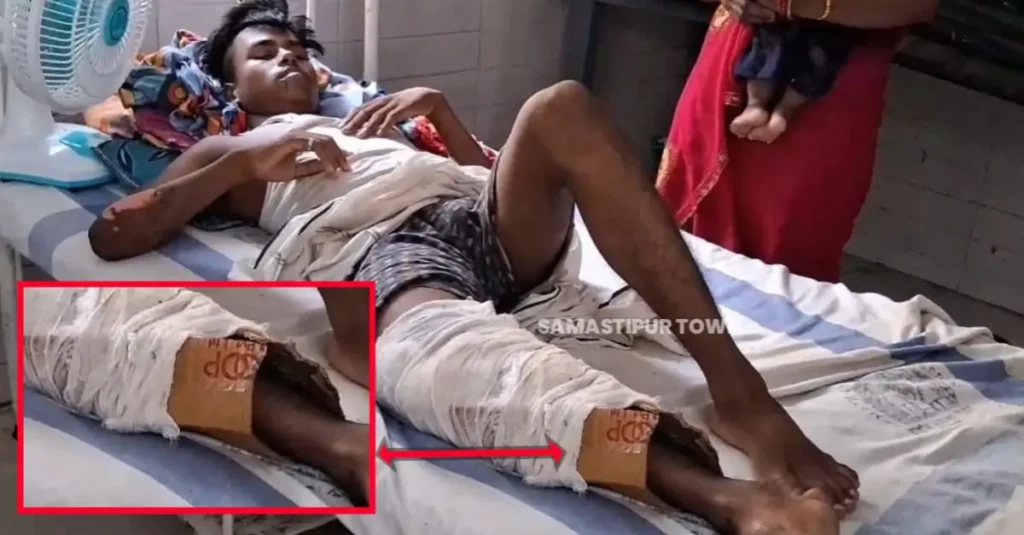 बिहार: एक्सीडेंट में युवक का पैर फ्रैक्चर हुआ तो प्लास्टर की जगह बांध दिया कार्टून, अस्पताल में चार दिन से... 1 20240612 161414