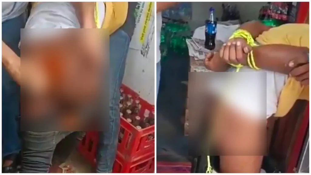 बिहार में चोर को तालिबानी सजा: चोर के मलद्वार में लाल मिर्च का पाउडर भर डाला 1 Picsart 24 08 27 10 41 00 302