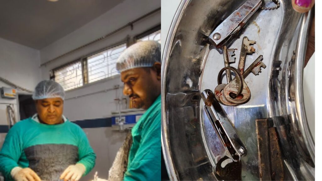 मोबाइल गेम खेलने से ऐसा मानसिक संतुलन बिगड़ा की युवक ने निगल लिया चाकू-चाबी और नेल कटर, कई दिनों से खा रहा था लोहा 1 doctor 2