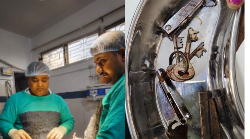 मोबाइल गेम खेलने से ऐसा मानसिक संतुलन बिगड़ा की युवक ने निगल लिया चाकू-चाबी और नेल कटर, कई दिनों से खा रहा था लोहा 1 doctor 2