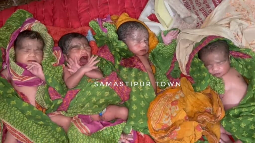 समस्तीपुर में महिला ने एक साथ दिया चार बच्चों को जन्म, मां के साथ सभी बच्चे स्वस्थ्य, पहले से भी है चार बच्चे 1 IMG 20250731 WA0075