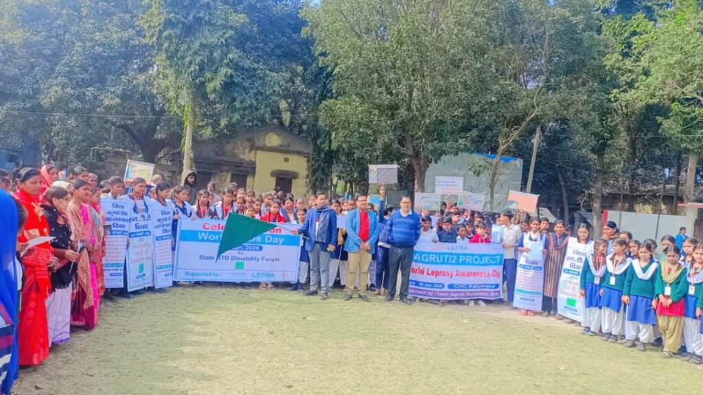 सामुदायिक स्वास्थ्य केंद्र कल्याणपुर में कुष्ठ उन्मूलन को लेकर जागरूकता कार्यक्रम आयोजित 1 IMG 20260131 WA0008
